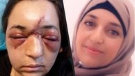 عکس قبل و بعد از شکافتن جمجمه یک زن + جزییات