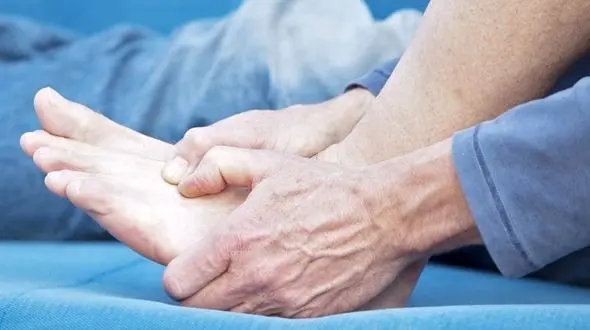 درمان نقرس بدون دارو