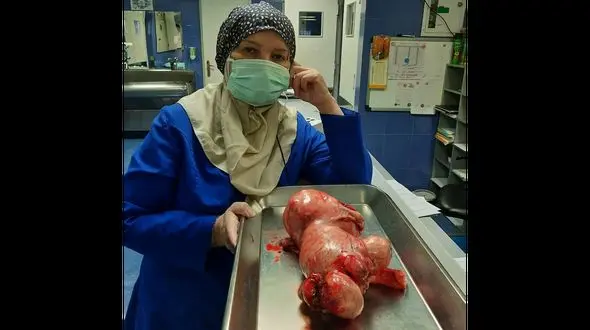 راز برآمدگی شکم زن تهرانی در بیمارستان یاس فاش شد / شوک به خانواده 