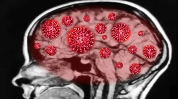 کرونا مغز را هم درگیر می کند؟
