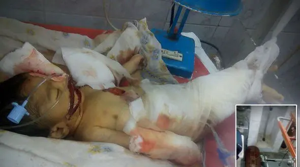 موش ها انگشتان دست و پای نوزادی را در بیمارستان خوردند+‌ عکس (+14) 