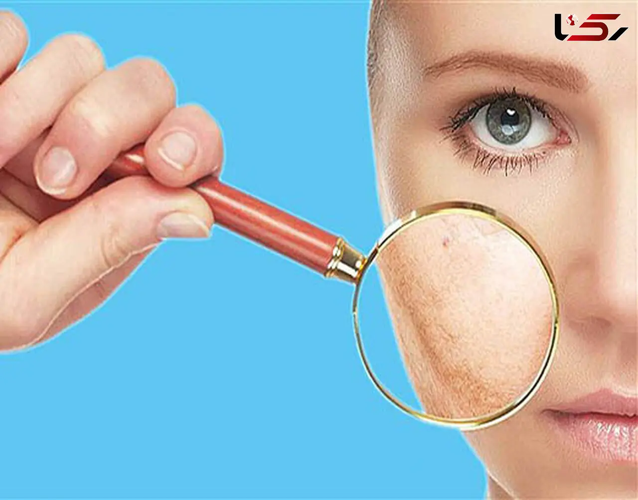 شایع ترین مشکلات پوستی در بین ایرانی ها