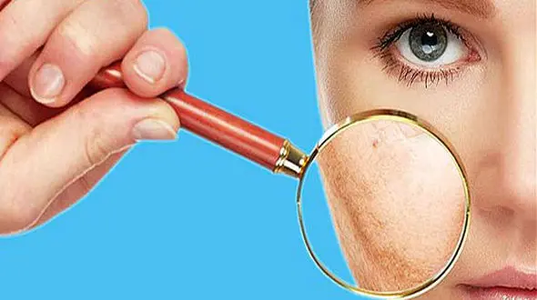 شایع ترین مشکلات پوستی در بین ایرانی ها