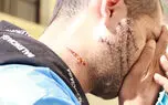 صورت این متهم را ببینید وحشت زده می شوید / خودزنی برای آزادی + فیلم و عکس
