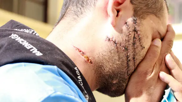 صورت این متهم را ببینید وحشت زده می شوید / خودزنی برای آزادی + فیلم و عکس