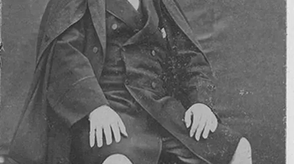 پزشک فرنگی ناصرالدین شاه 