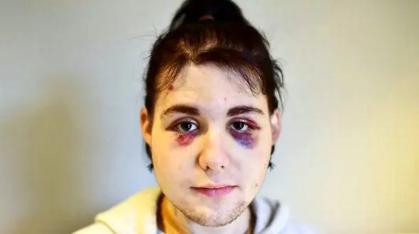 ضرب و شتم شخصی در اتوبوس که هم دختر بود هم پسر +عکس