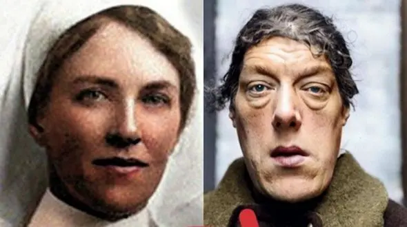 فیلم واقعی زیبا ترین زنی که تبدیل به زشت ترین زن دنیا شد ! / دلتان کباب می شود !