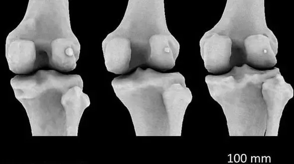 استخوان منقرض شده دوباره به بدن انسان ها بازگشت!+عکس