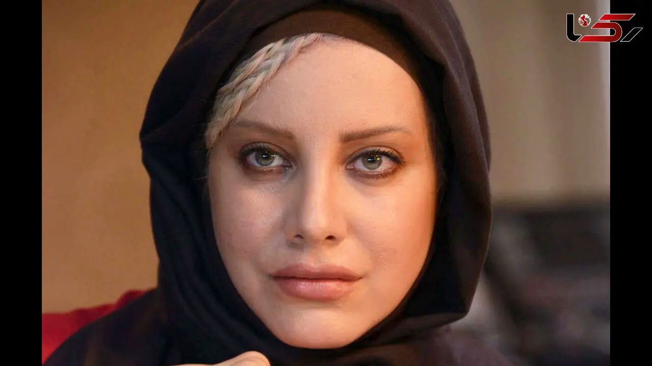 تاثیر مخرب جراحی زیبایی بر زندگی حرفه‌ای شراره رخام