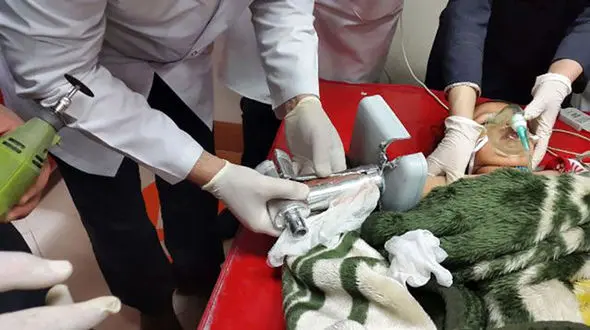 چرخ گوشت بلعید، آتش‌نشانان نجات دادند/ ماجرای تلخ کودک 6 ساله