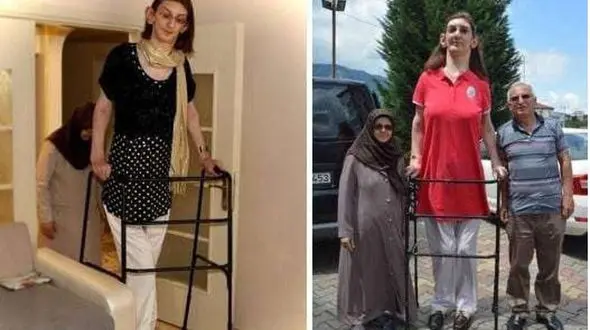  قد بلندترین زن جهان کیست ؟! + عکس های شوک آور