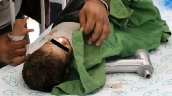  چرخ گوشت دست کودک 19 ماهه شهریاری را بلعید + عکس 