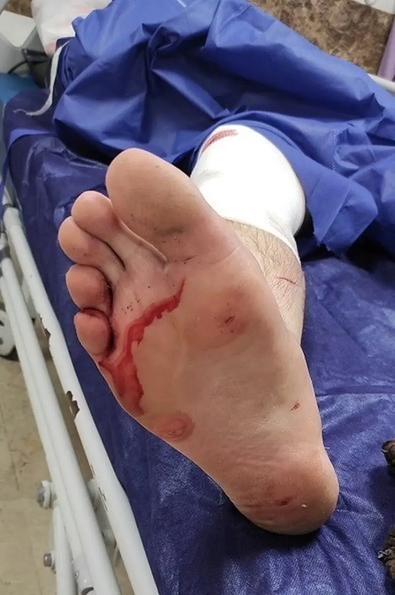BdZdkkNiZl8I