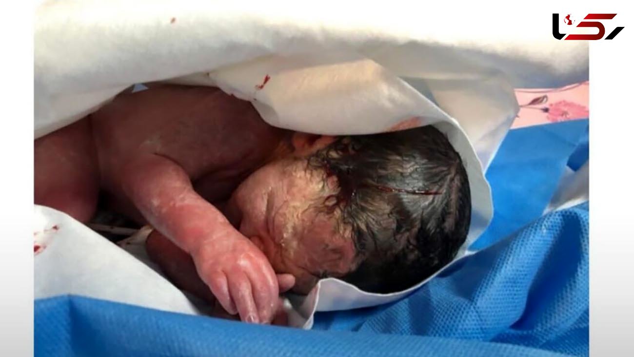 تولد نوزاد سالم از مادر کرونایی در اهواز