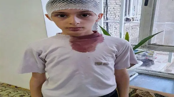 اولین عکس از دانش آموز  کتک خورده از معلم اشنویه ای !