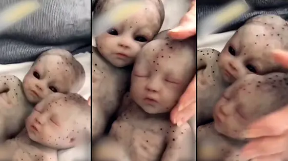 فیلم تولد اولین دوقلوهای فضایی از انسان / پشت پرده شرم آور نوزادان عجیب الخلقه !