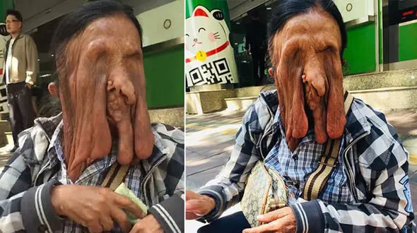 وحشتناک‌ترین زن جهان که حاضر به جراحی چهره خود نیست + عکس ترسناک