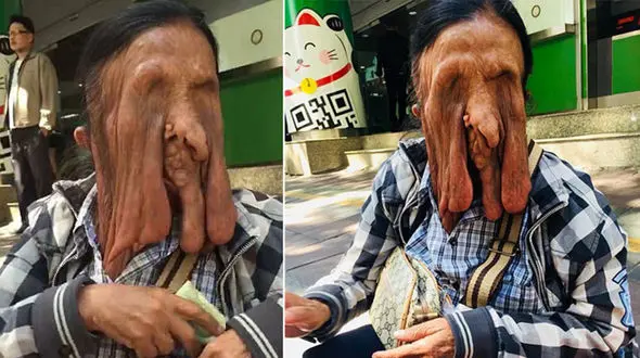 وحشتناک‌ترین زن جهان که حاضر به جراحی چهره خود نیست + عکس ترسناک