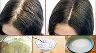 روش های طبیعی برای رشد موهای ریخته