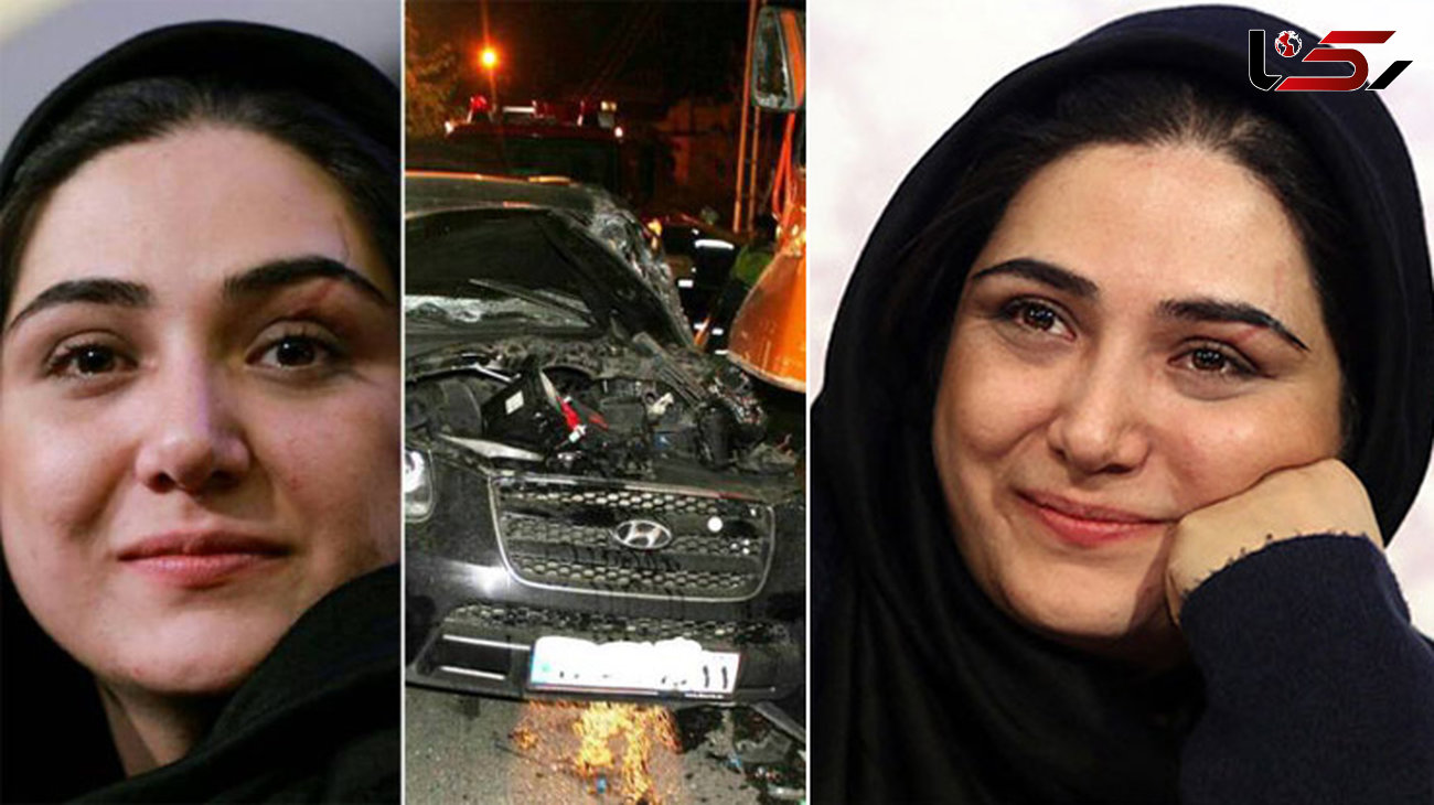 یادگاری تصادف وحشتناک روی چهره سوپراستار زن سینمای ایران!  +تصاویر 