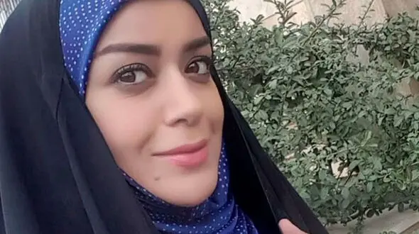 چهره جدید الهام چرخنده بعد از عمل + جدیدترین عکس