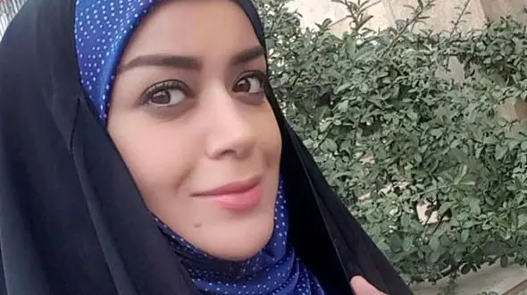 چهره جدید الهام چرخنده بعد از عمل + جدیدترین عکس