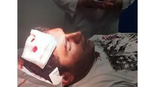 حمله مردان مسلح به ماموران منابع طبیعی +عکس