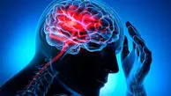 زمان طلایی درمان سکته مغزی / آقایان بیشتر از خانم ها جدی بگیرند