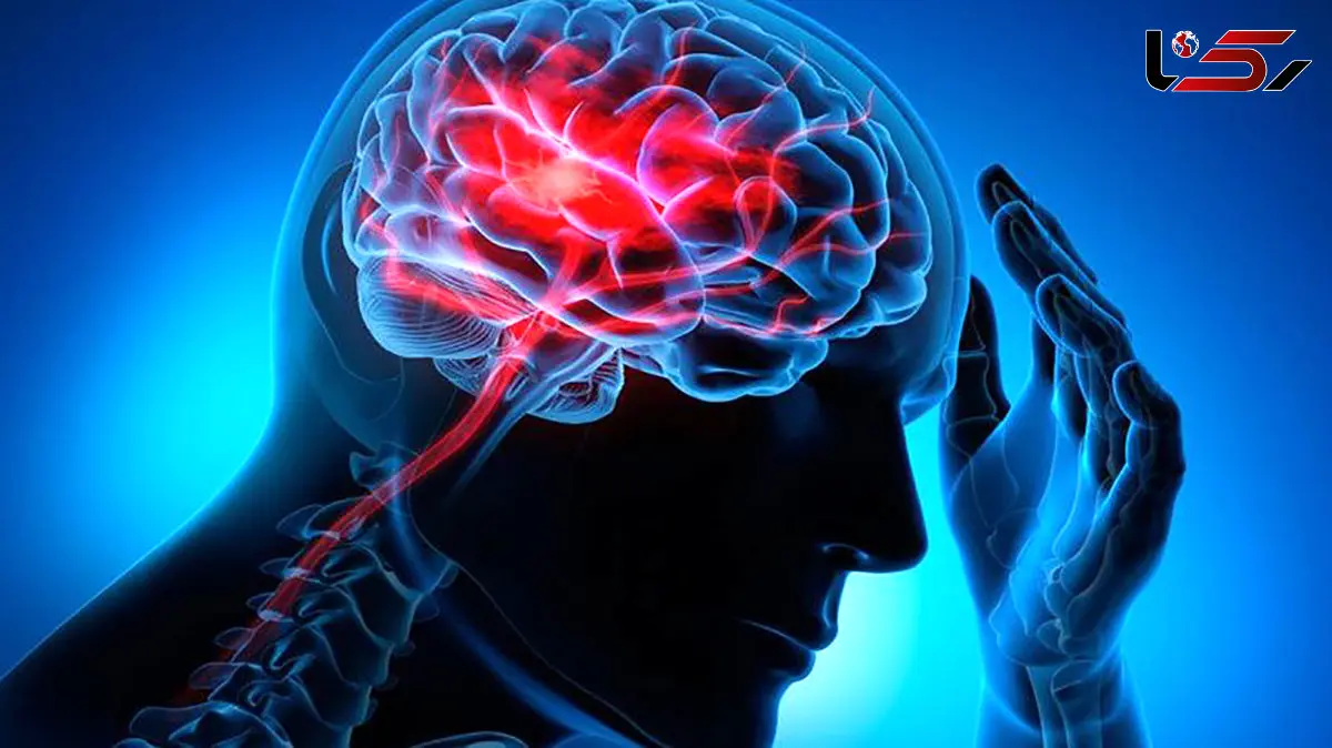 زمان طلایی درمان سکته مغزی / آقایان بیشتر از خانم ها جدی بگیرند