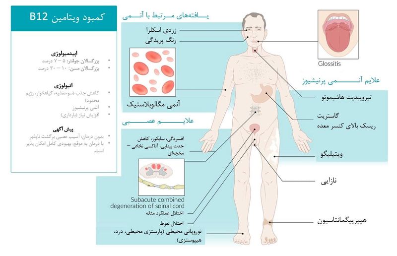 کمبود ویتامین B12 و فولات