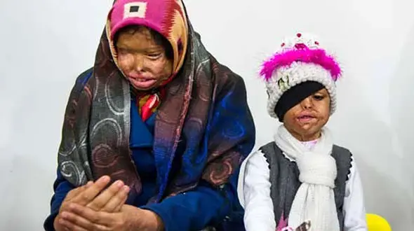 اسیدپاشی پدر کرمانی بی رحم روی همسر و 2 دخترش / این فیلم اشک تان را درمی آورد
