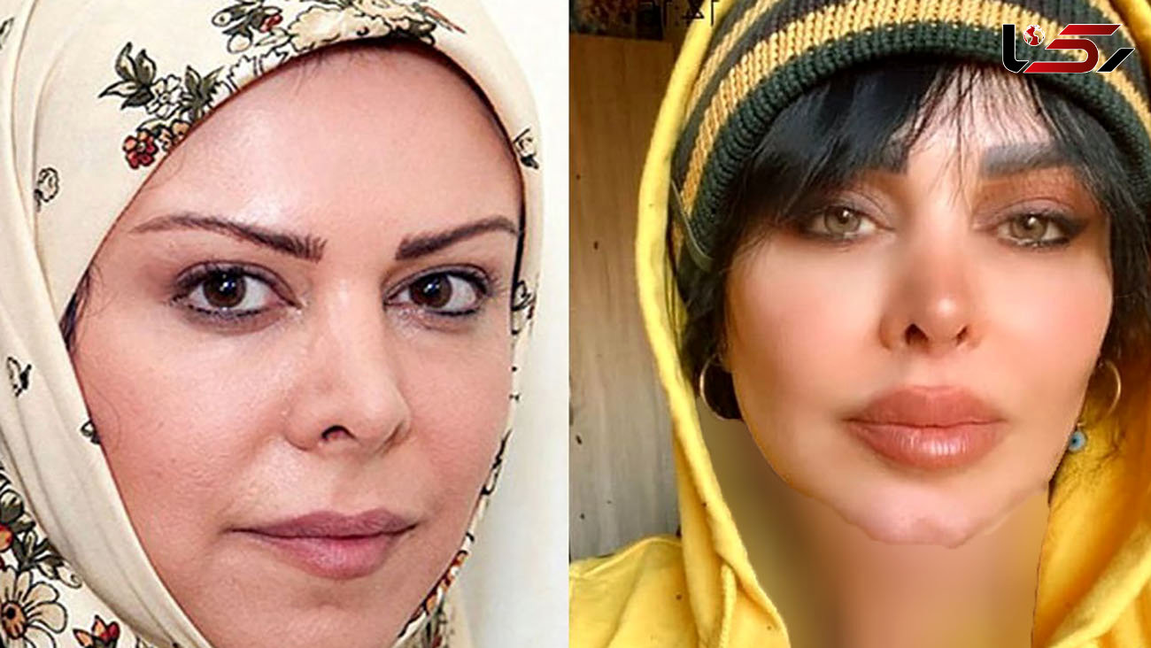تغییر چهره بازیگران رویای خیس بعد 17 سال ! خانم بازیگران جوانتر از قبل + اسامی و عکس ها