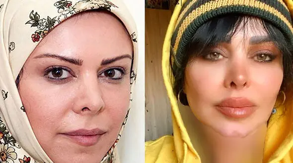 تفاوت فاحش فلور نظری و خواهرش !  + عکس دکتر فریبا نظری با پوشش جذاب تر از فلور !