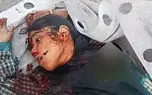 جنگ یکماهه شد با 237 زن و صدها کودک ایرانی کشته شده / کنوانسیون‌های ژنو در بوته آزمایش/ تلاقی حقوق بین‌ الملل بشردوستانه و فجایع جنگی 
