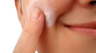 درمان های خانگی برای رفع اگزمای پوستی+دستور العمل