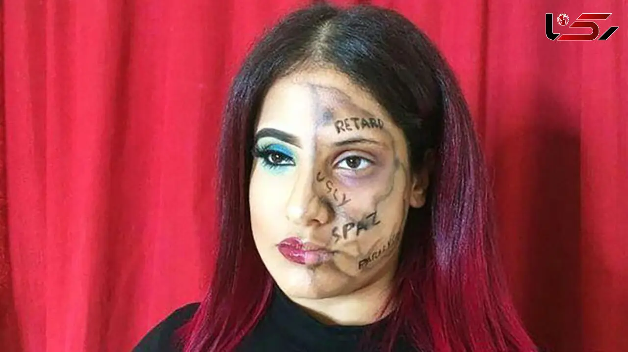 
دختر معلولی که کلمات آزار دهنده را روی صورتش نوشت + عکس
