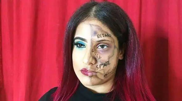 
دختر معلولی که کلمات آزار دهنده را روی صورتش نوشت + عکس
