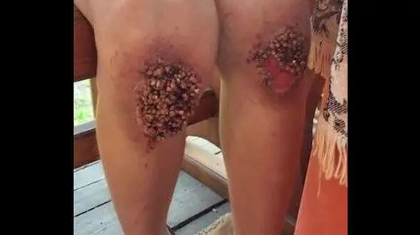 شکنجه عجیب و هولناک ناپدری و مادر بی رحم با پسر 8 ساله+ عکس