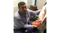 حمام خون در بیمارستان معروف تهران /  دکتر کلیه چاقو چاقو شد! + تصاویر