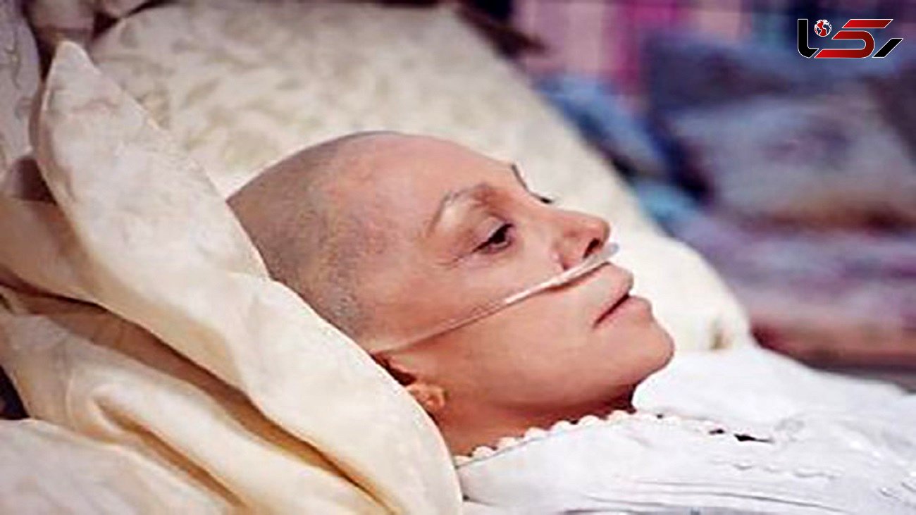 زنان بیشتر به این سرطان ها مبتلا می شوند + راه های پیشگیری از آنها