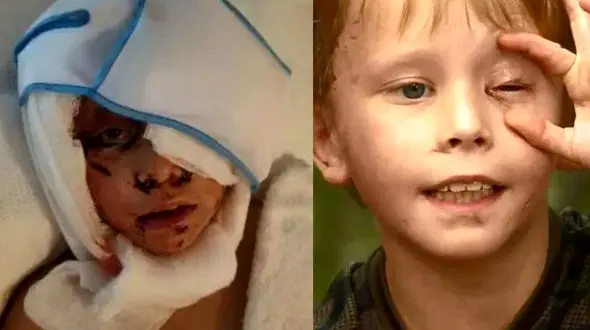 عکس از تیکه پاره شدن یک پسربچه در حمله حیوان درنده ! + جزییات