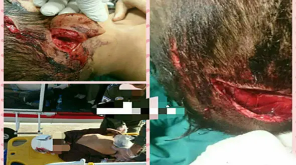 خرس وحشی یک چوپان نوجوان را تیکه پاره کرد+عکس16 +