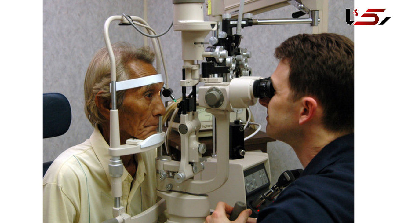  عامل افزایش خطر نابینایی مشخص شد
