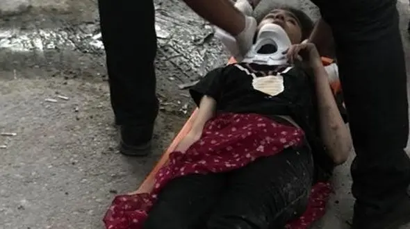 عکس 16+ / سقوط دختر 13 ساله از طبقه سوم ساختمان در بندرعباس