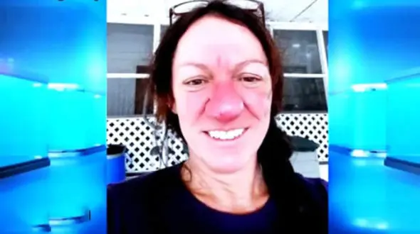 رشد بینی این زن از ۱۵ سالگی آغاز و هرگز متوقف نشد+عکس های جالب 