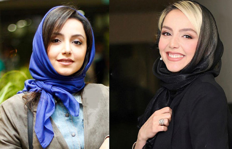 تغییر چهره نازنین بیاتی