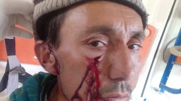 بلایی که پلنگ بر سر یک مرد در کلاله آورد + عکس