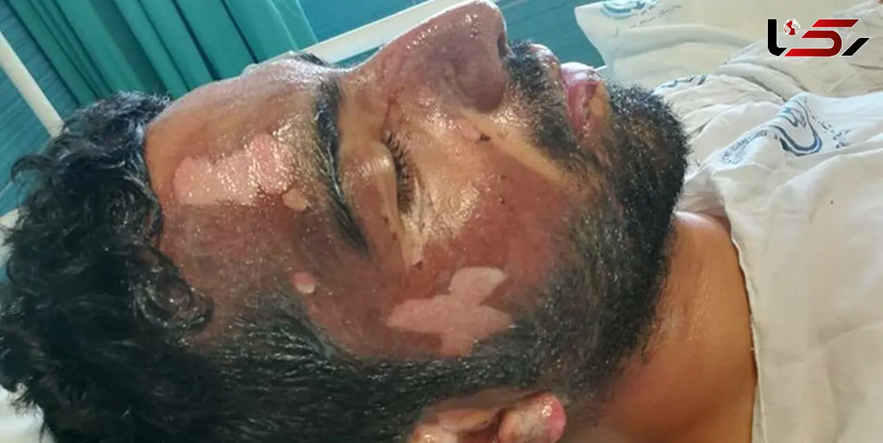 عکس های تکاندهنده از سوختن یک پلیس فداکار در صحنه نجات راننده بلوچ! + جزییات تلخ