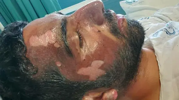 عکس های تکاندهنده از سوختن یک پلیس فداکار در صحنه نجات راننده بلوچ! + جزییات تلخ